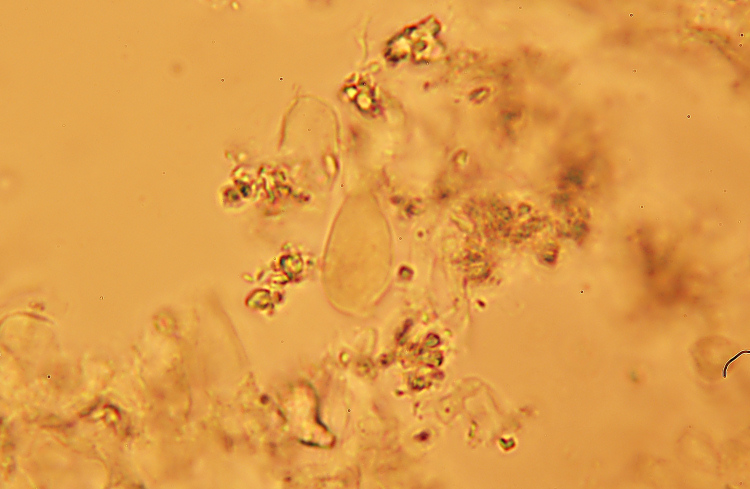 Crosta bianca da det. - foto 7006 (Crustomyces subabruptus)